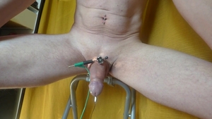 E-Stim penis Pins Electrodes sperm Ejac
